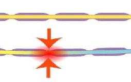 「神経痛」ってなんだろう?
